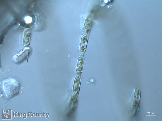 Photo of Eucampia zodiacus
